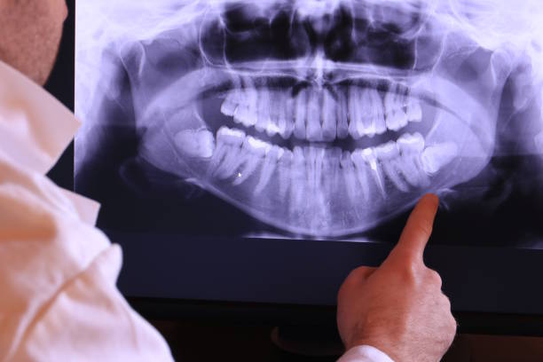 Best Emergency Tooth Extraction in Winterset, IA