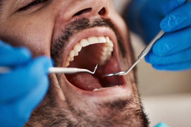 Best After-Hours Dental Trauma Care in Winterset, IA