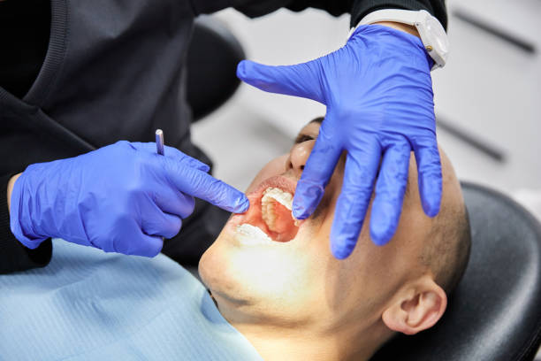 Best Emergency Wisdom Teeth Removal in Winterset, IA